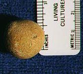 Stone ball